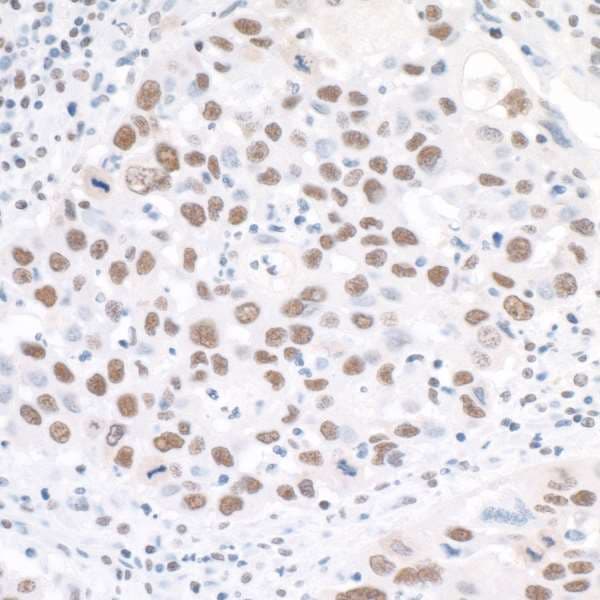 CCNK Antibody (aa530-580)