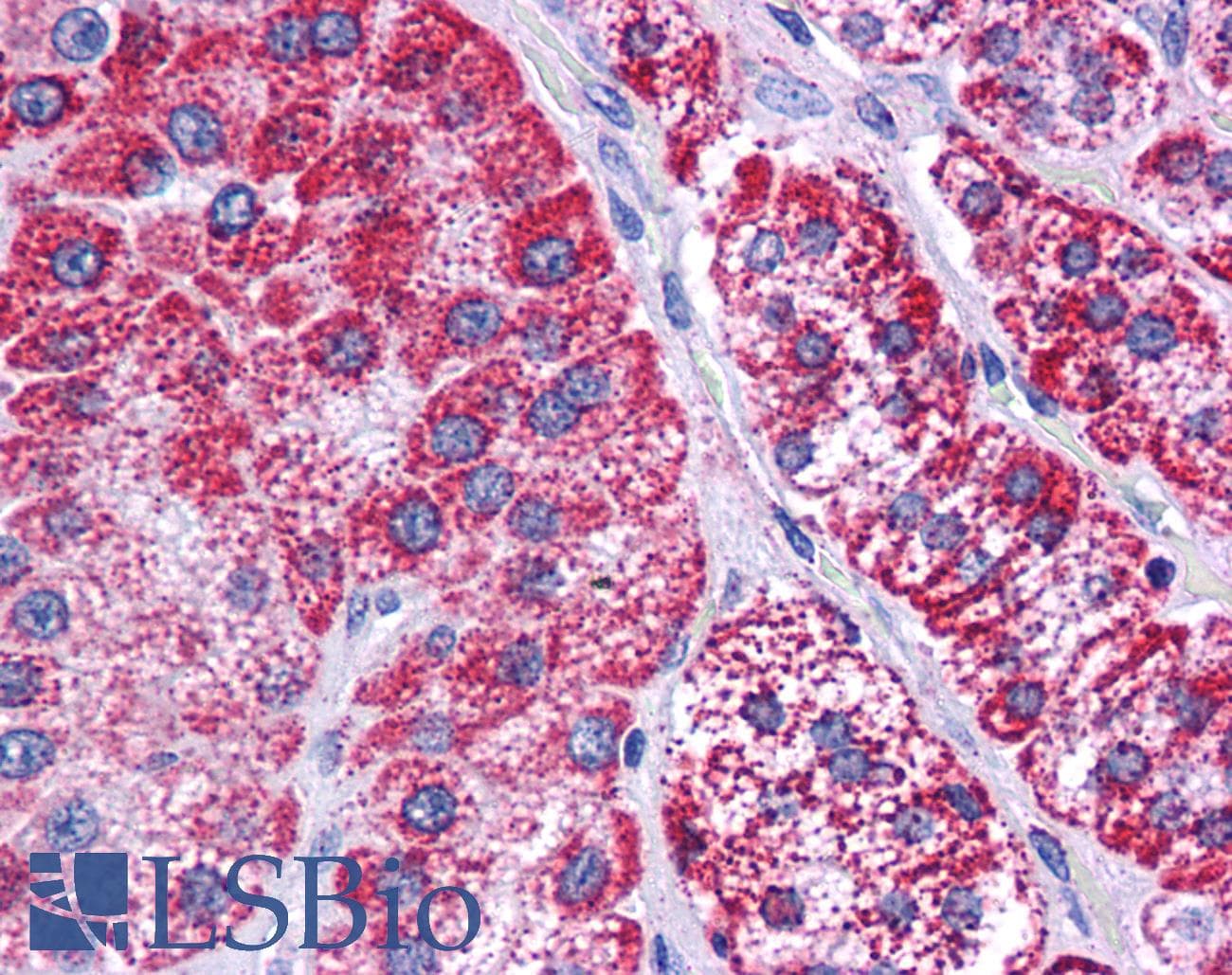 Polyclonal Rabbit anti-Human HADHB Antibody (aa351-400, IHC, WB)