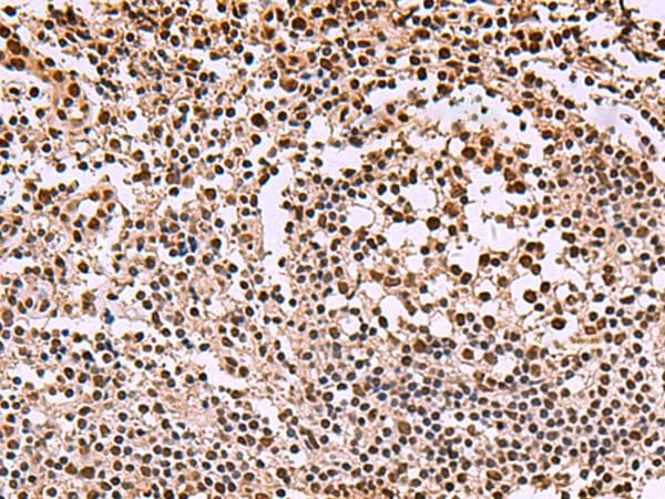 SMAD7 Antibody