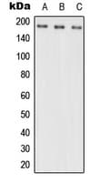IHC-plus™ Polyclonal Rabbit anti-Human NRXN3 Antibody (aa516-555, IHC, WB)