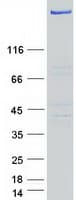 Human USP24 Protein (Recombinant Myc-DDK (Flag))