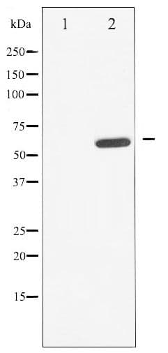 Polyclonal Rabbit anti-Human CDC25A Antibody (phospho-Ser178, IHC, WB)