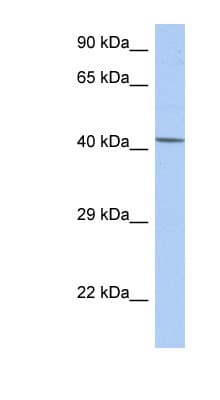 NR5A1 / SF1 Antibody (aa143-192)