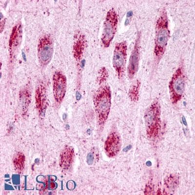 PathPlus™ Polyclonal Rabbit anti-Human GPR3 Antibody (Extracellular Domain, IHC, IF)