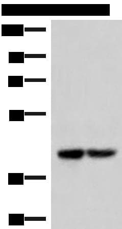 Polyclonal Rabbit anti-Human IQCD Antibody (IHC, WB)