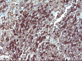 PathPlus™ IL10RA Antibody (clone 1D10)