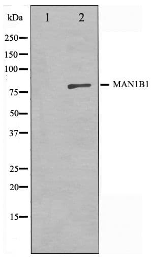 Polyclonal Rabbit anti-Human MAN1B1 Antibody (WB)