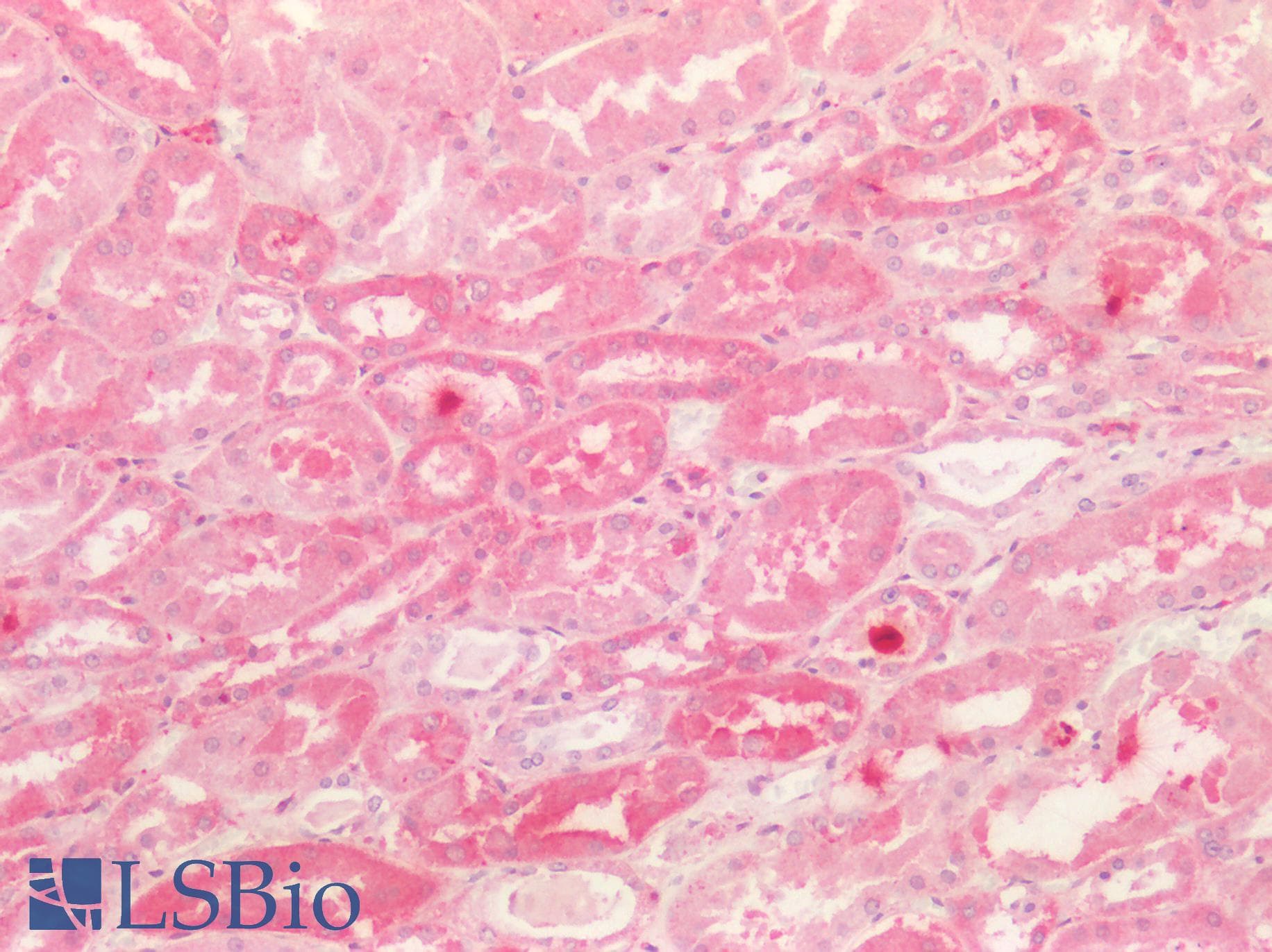 PathPlus™ KNG1 / Kininogen / Bradykinin Antibody (aa58-70)