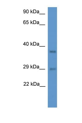 Polyclonal Rabbit anti-Rat MED19 Antibody (aa68-117, WB)