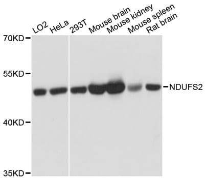 NDUFS2 Antibody