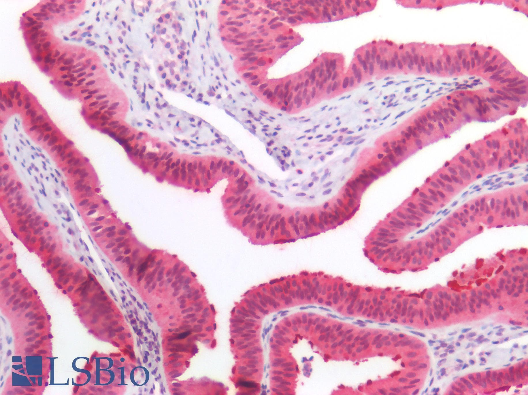 PathPlus™ CCDC6 Antibody