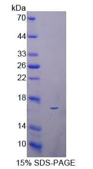 Mouse Reg3b Protein (Recombinant His,N-terminus)