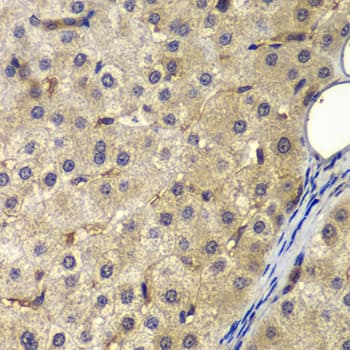 AP2A2 Antibody