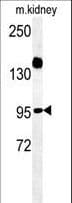 Polyclonal Rabbit anti-Human ARMC5 Antibody (aa599-628, IHC, WB)