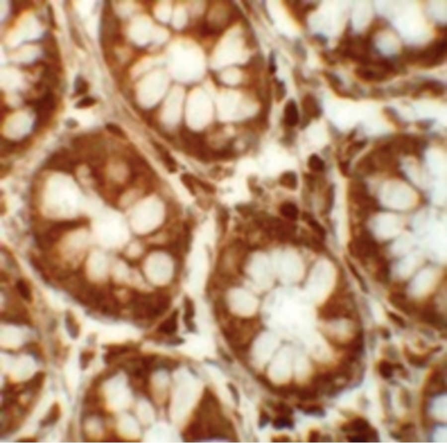 HUFI-2 / LRRFIP2 Antibody