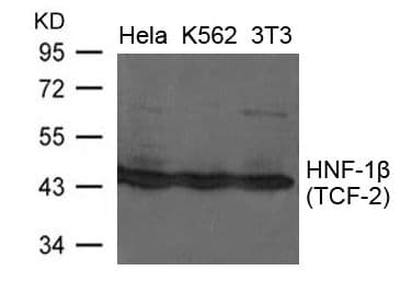 HNF1B / HNF1 Beta Antibody