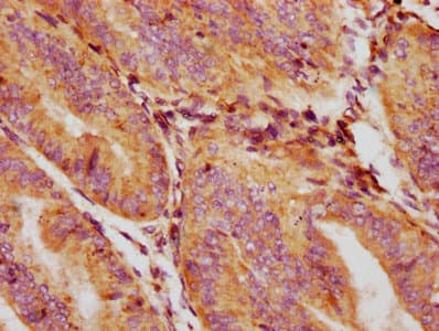 GDF5 / GDF-5 Antibody (aa202-501)
