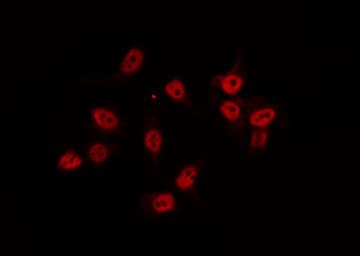 AKIP1 / BCA3 Antibody