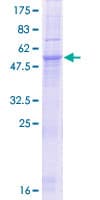 Human SLC25A21 / ODC1 Protein (Recombinant GST)