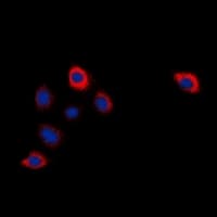 CYP2W1 Antibody (Internal)