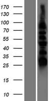 DUSP8 Protein (Over-Expression Lysate Myc-DDK (Flag))