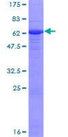 Human EPHA10 / EPH Receptor A10 Protein (Recombinant GST)