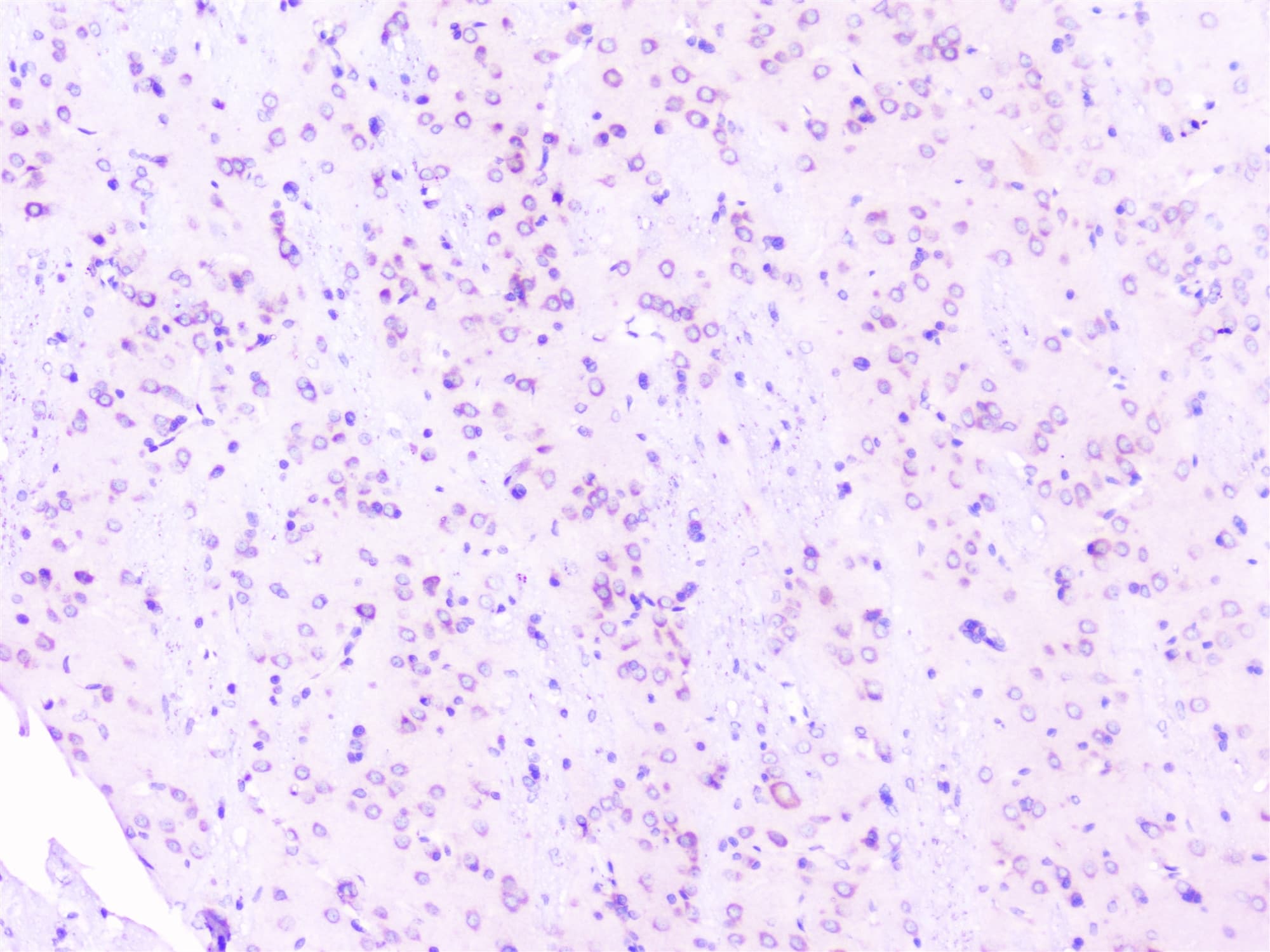 Polyclonal Rabbit anti-Human RPS3 / Ribosomal Protein S3 Antibody (IHC, WB)