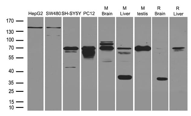 Polyclonal Rabbit anti-Human NGFR / CD271 / TNR16 Antibody (WB)