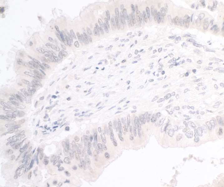Trimethylguanosine Synthase 1 Antibody (aa803-853)