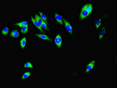 MCL1 / MCL 1 Antibody