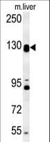 DENND5B Antibody (aa1066-1094)