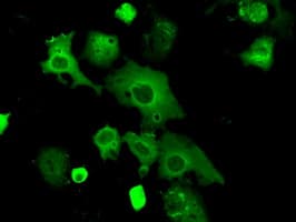 PRKAR2A Antibody (clone OTI1C4)
