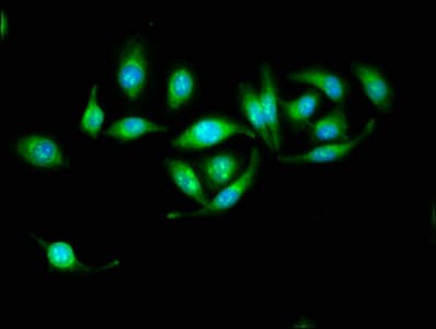 HSD17B10 / HADH2 Antibody (aa2-261)