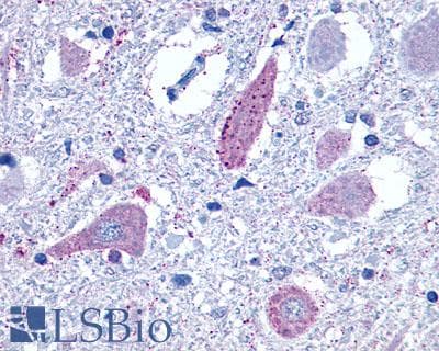 PathPlus™ GRM8 / MGLUR8 Antibody (C-Terminus)