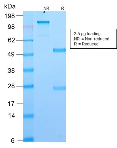 PathPlus™ Recombinant Monoclonal Rabbit anti-Human ANO1 / DOG1 / TMEM16A Antibody (clone DG1/2564R, aa 2-101, IHC)