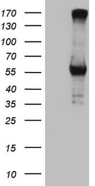 Monoclonal Mouse anti-Human CPM / Carboxypeptidase M Antibody (clone OTI7C1, aa124-423, IHC, WB)