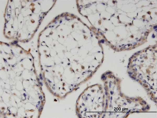 FZD7 / Frizzled 7 Antibody (clone 4D9)