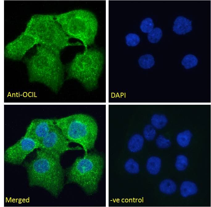 IHC-plus™ Polyclonal Goat anti-Human CLEC2D / OCIL / LLT1 Antibody (aa122-131, IHC, IF, WB)