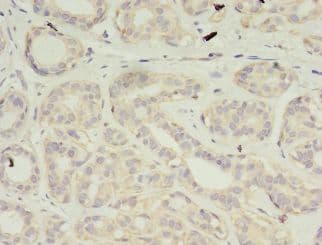 VSIG2 Antibody (aa24-243)
