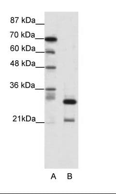 Polyclonal Rabbit anti-Human HMOX2 / Heme Oxygenase 2 Antibody (N-Terminus, IHC, WB)