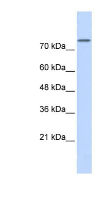 PLD2 / Phospholipase D2 Antibody (aa467-516, HRP)