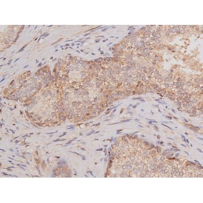 Polyclonal Rabbit anti-Human c-Kit / CD117 Antibody (IHC, IF, WB)