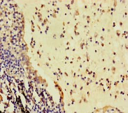 RSPO3 Antibody