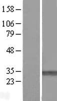 PMM1 Protein (Over-Expression Lysate Myc-DDK (Flag))