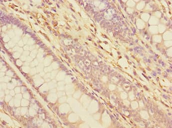 TXNDC5 / ERP46 Antibody