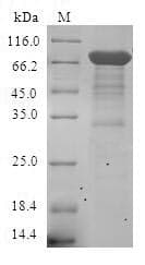 Human ESRRA / ERR Alpha Protein (Recombinant GST, N-terminus)