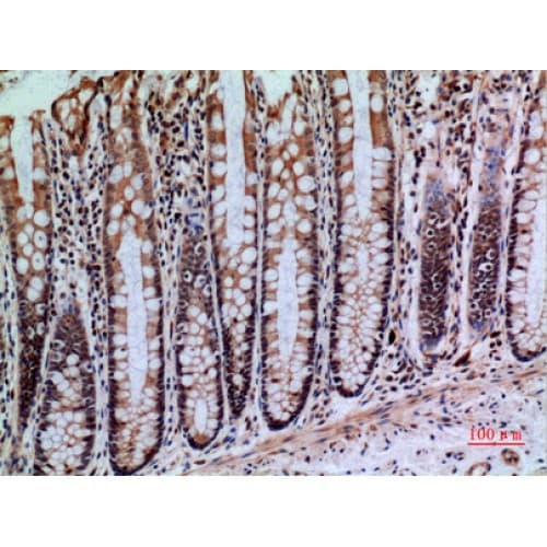 PTPRJ / CD148 Antibody (861-910 aa, Internal)