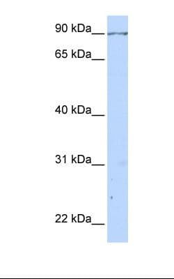 CALD1 / Caldesmon Antibody (aa578-627)