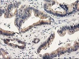 ILVBL Antibody (clone OTI1A12)