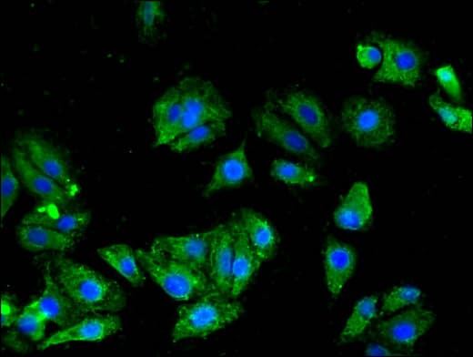 KCNC1 / Kv3.1 Antibody